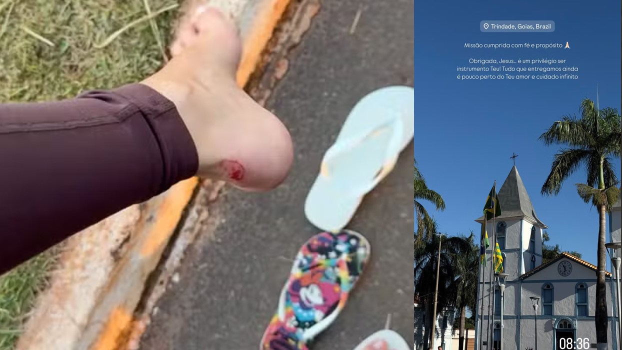 Gabriela Versiani mostra ferimentos após completar caminhada religiosa: ’18 km’ Gabriela Versiani mostra ferimentos após completar caminhada religiosa: ’18 km’